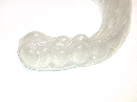 Ferula-dental-blanqueamiento