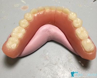 Protesis dental rota