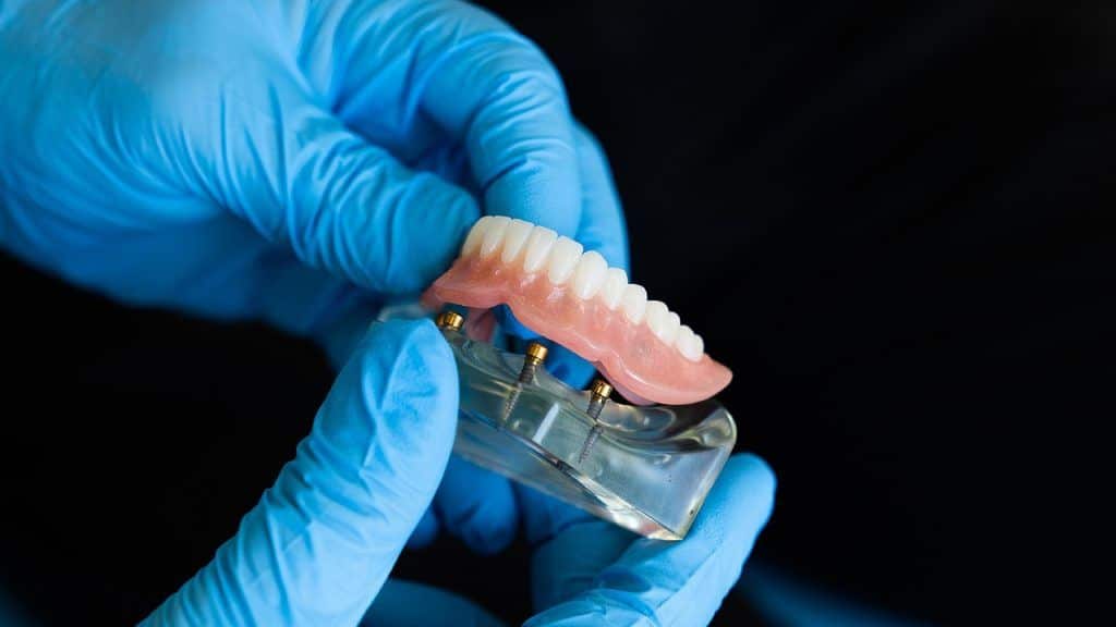 cuanto dura una protesis dental